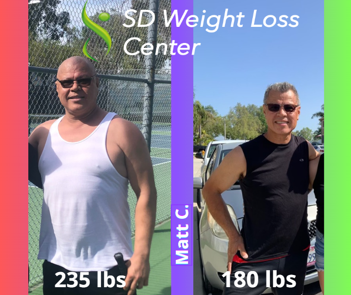 Before and after 1 jorge